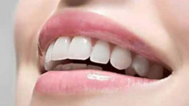 Lee más sobre el artículo Desarrollaron un esmalte artificial para reparar piezas dentales