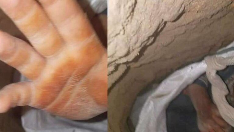 Lee más sobre el artículo Murió el nene que había caído a un pozo de 25 metros en Afganistán