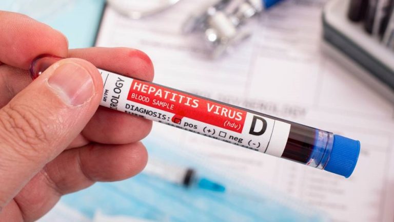 Lee más sobre el artículo Alerta en Europa por hepatitis de origen desconocido que afecta a niños menores de 10 años