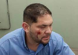 You are currently viewing Otro colectivero fue agredido en un asalto en Moreno: “Estamos solos”