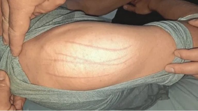 Lee más sobre el artículo Un policía denunció que fue atacado por un espíritu maligno: fue internado en una sala de Salud Mental
