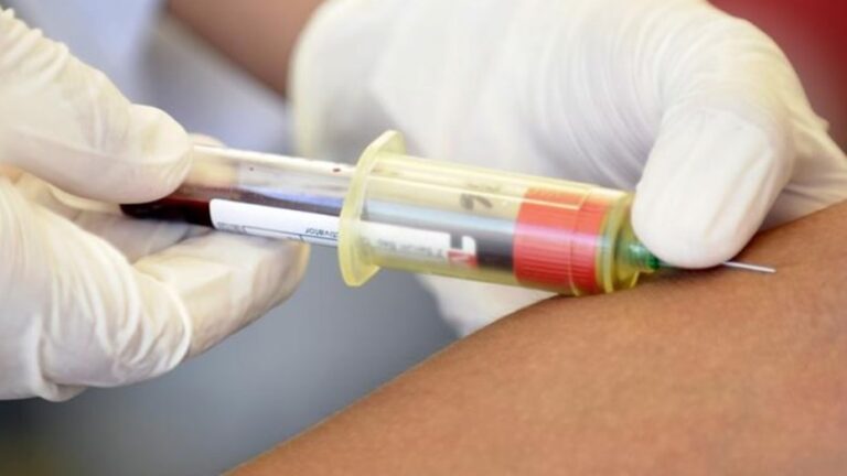 Lee más sobre el artículo Un tercer enfermo de VIH logra curarse tras un trasplante de células madre