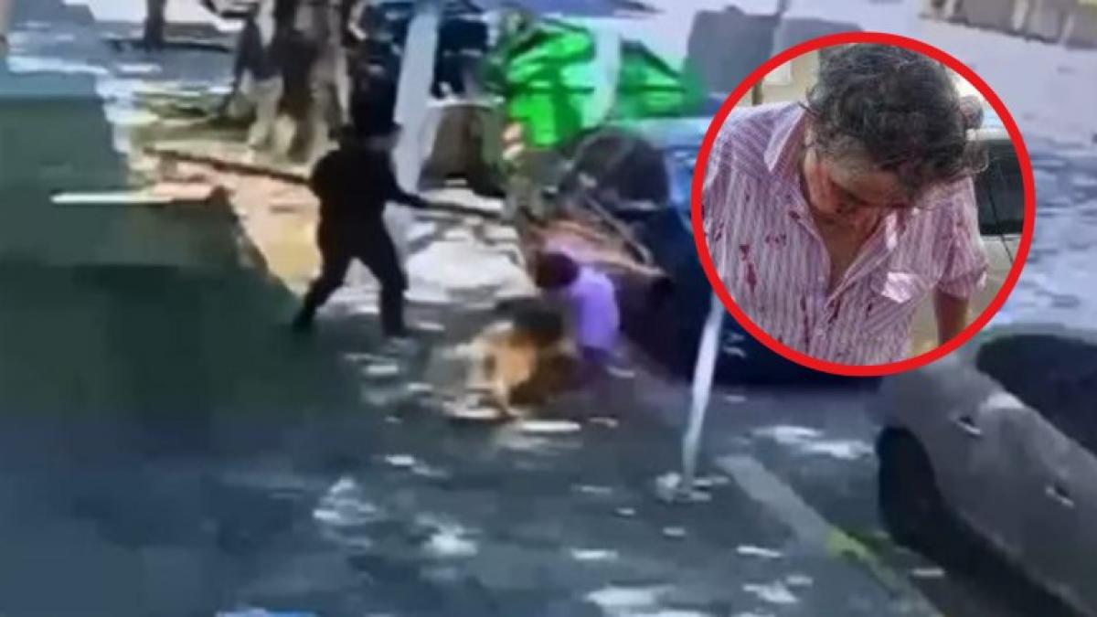 Read more about the article Feroz golpiza en Boedo: le pidió que levante la caca de su perro y fue atacado a correazos