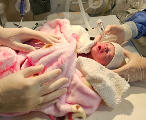 Lee más sobre el artículo Emotivo nacimiento trigemelar en la Maternidad Provincial: Ailany, Angie y Arlet llegaron al mundo sanas y fuertes